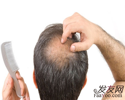 植發(fā)價(jià)格計(jì)算