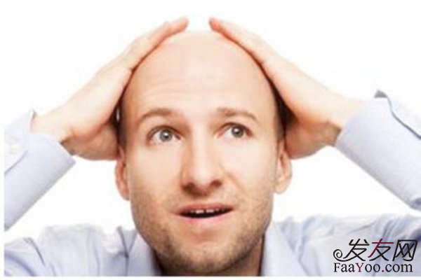  男性脫發(fā)應(yīng)該怎樣預(yù)防？