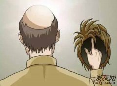 植發(fā)真的值得這么貴嗎？