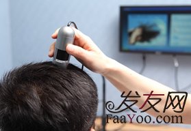 杭州植發(fā)價(jià)格多少錢