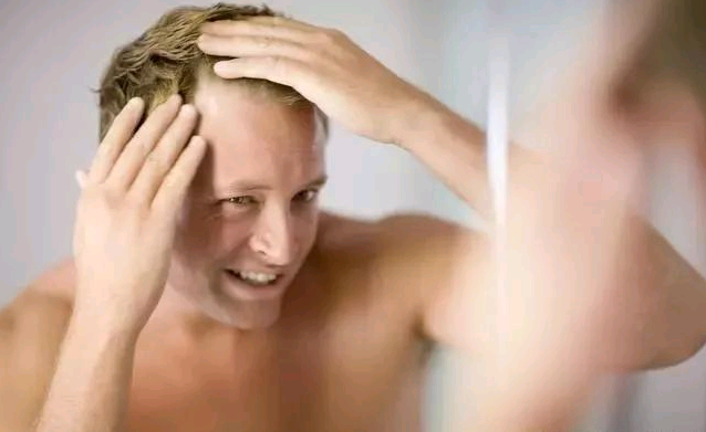 用米諾地爾沒有狂脫期正常嗎