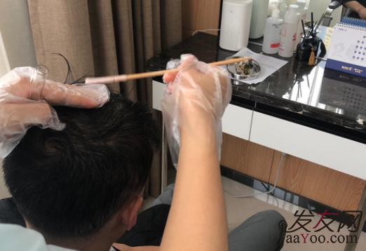 青島雍禾植發(fā)醫(yī)院