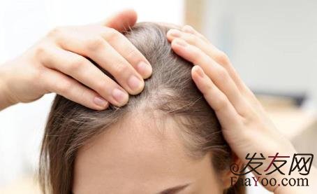 植發(fā)技術哪種比較好？加密種植是什么意思？