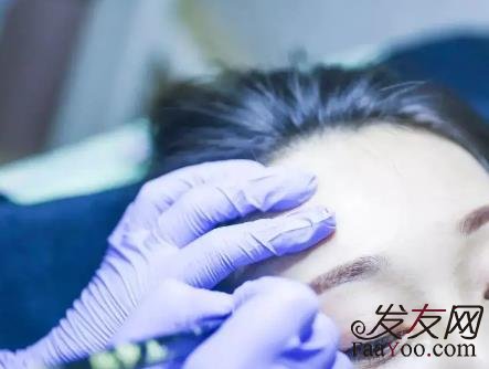 紋眉和植發(fā)該怎么選擇？ 這些注意事項(xiàng)一定要了解！