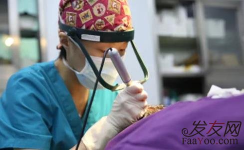 怎么選擇合適靠譜的植發(fā)醫(yī)生？小心植發(fā)陷阱！