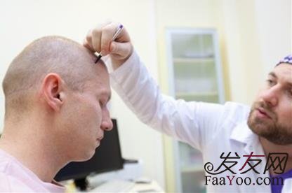 植發(fā)到底是不是智商稅？移植后的頭發(fā)還會繼續(xù)掉嗎？