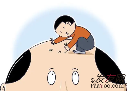 植發(fā)真的靠譜嗎？是不是網(wǎng)上說的拆東墻補(bǔ)西墻？