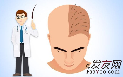 植發(fā)后頭皮發(fā)癢怎么回事？會不會影響毛囊成活率？