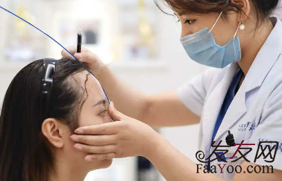 植發(fā)價格到底如何計算？記住這三個關(guān)鍵因素！