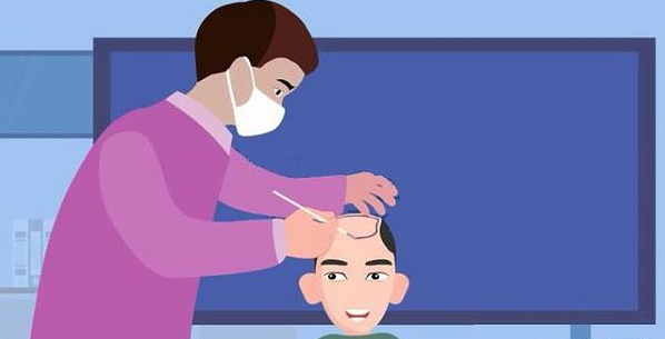 植發(fā)醫(yī)院排名