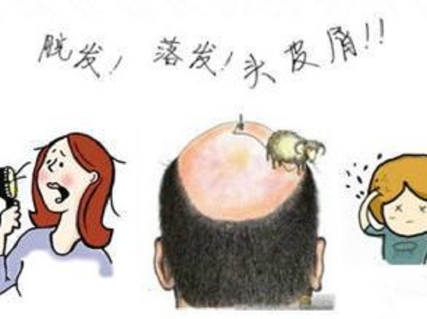 常見(jiàn)脫發(fā)類(lèi)型有哪幾種