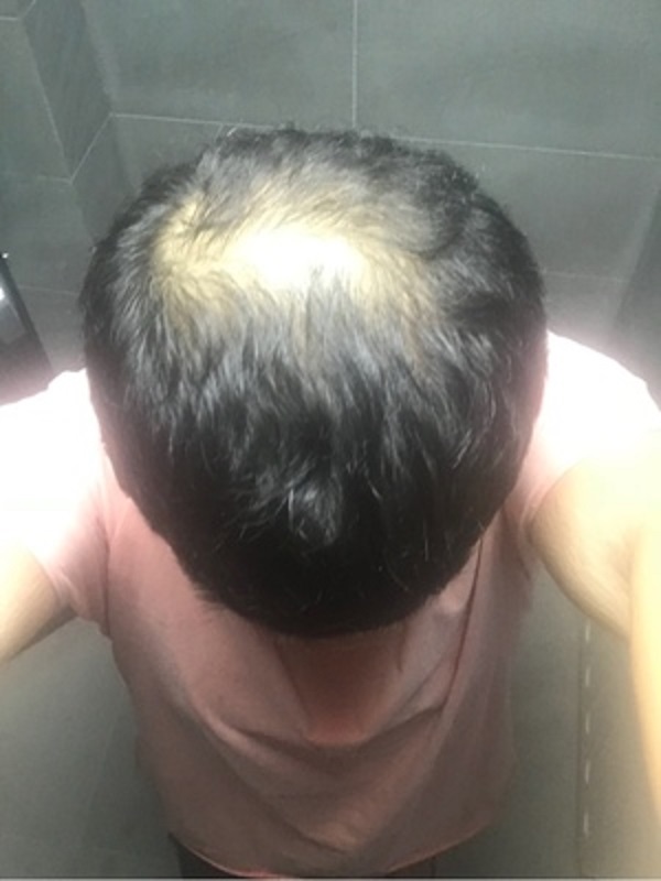 遮蓋神器，蘇玫氏頭發(fā)纖維粉