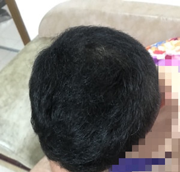 遮蓋神器，蘇玫氏頭發(fā)纖維粉