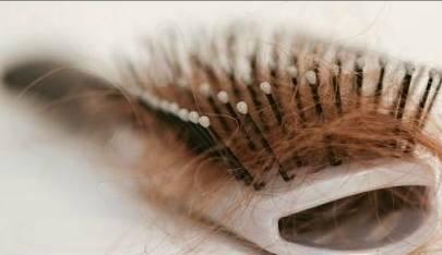 年輕人怎么去防止大把大把的掉發(fā)