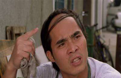 遺傳性脫發(fā)是什么？