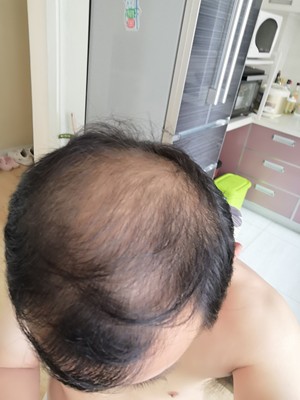 補發(fā)神器：蘇玫氏增發(fā)纖維粉