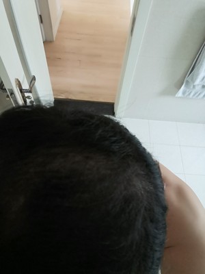 補發(fā)神器：蘇玫氏增發(fā)纖維粉