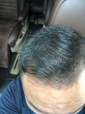 增發(fā)纖維讓我變回小鮮肉