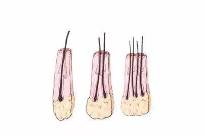 植發(fā)是多少錢一個(gè)單位