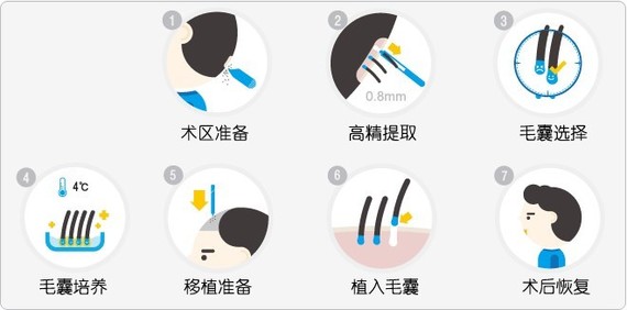 植發(fā)中的FUE和FUT有什么區(qū)別