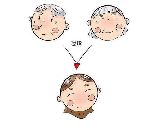 遺傳脫發(fā)可以治療嗎