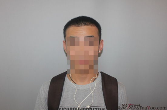 天津新發(fā)現(xiàn)植發(fā)1500單位，組團5折植發(fā)好醫(yī)生活動