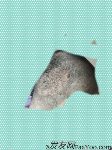 植發(fā)好醫(yī)生：沈陽牛大夫植發(fā)讓我做了一直想做的事情