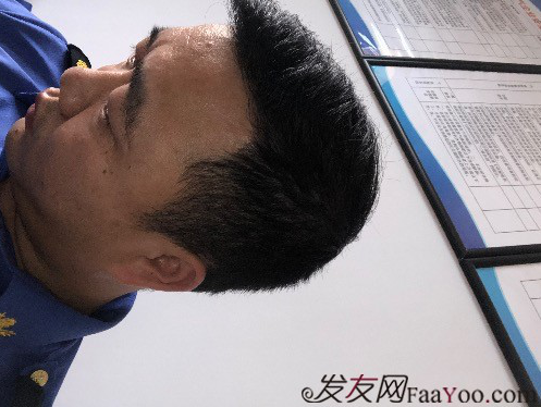 我在河南植了發(fā)，頭頂加密3000單位&nbsp;