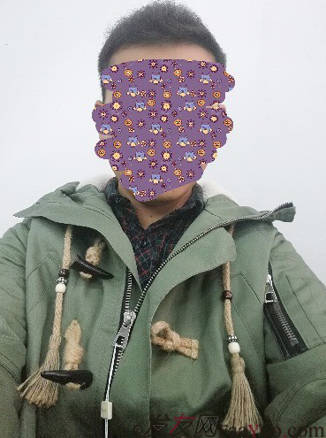 大麥微針植發(fā)案例，植發(fā)過程讓我越來越自信