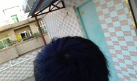 植發(fā)日記南昌廣濟(jì)植發(fā)，慢慢看我改變從此恢復(fù)自信