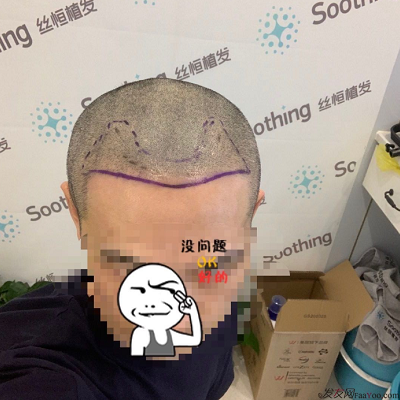 相約重慶植發(fā)，等待枯木逢春，意氣風(fēng)發(fā)之時(shí)。