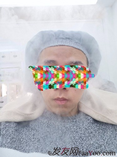 南昌科發(fā)源植發(fā)（現(xiàn)大麥微針），看看大額頭怎么蛻變的