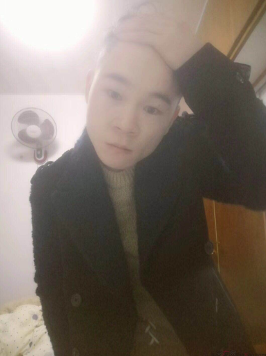 杭州大麥微針植發(fā)2300單位案例，來自脫發(fā)者的內(nèi)心陳述