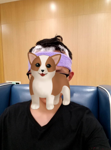 從脫發(fā)到植發(fā)的歷程，廣州大麥微針前額植發(fā)FUE2200單位