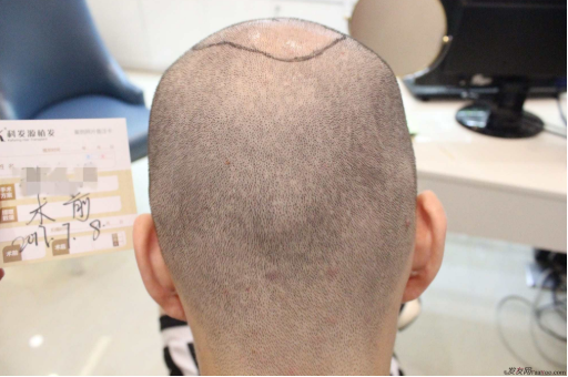 上海大麥微針2400Ptt頭頂加密.與發(fā)友們一起期待