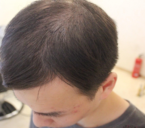 上海大麥微針2400Ptt頭頂加密.與發(fā)友們一起期待