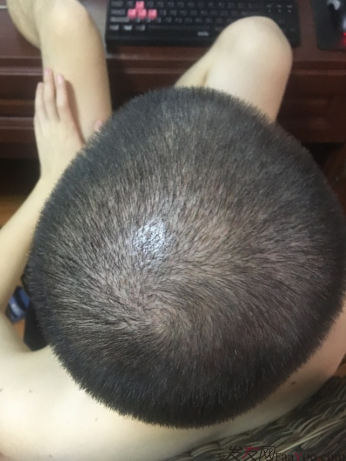 上海大麥微針2400Ptt頭頂加密.與發(fā)友們一起期待