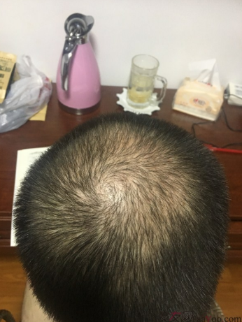 上海大麥微針2400Ptt頭頂加密.與發(fā)友們一起期待