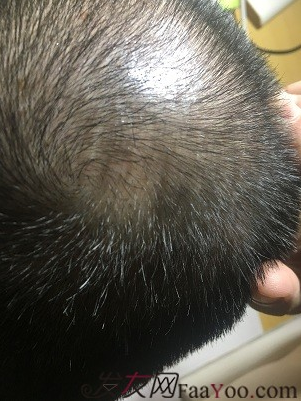 上海大麥微針2400Ptt頭頂加密.與發(fā)友們一起期待