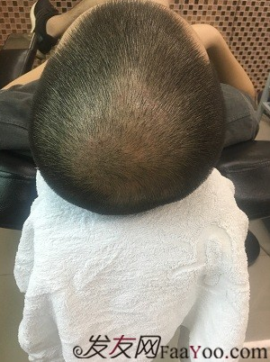 上海大麥微針2400Ptt頭頂加密.與發(fā)友們一起期待