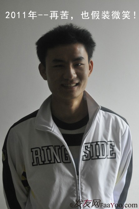 長沙大麥微針3000毛囊單位 漫漫生發(fā)路，雖難猶未悔！