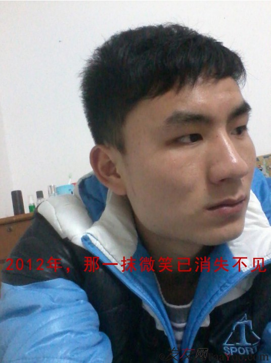 長沙大麥微針3000毛囊單位 漫漫生發(fā)路，雖難猶未悔！