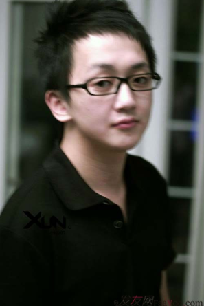 4級脫發(fā)植發(fā)分享我的經(jīng)歷，成都植發(fā)2800單位