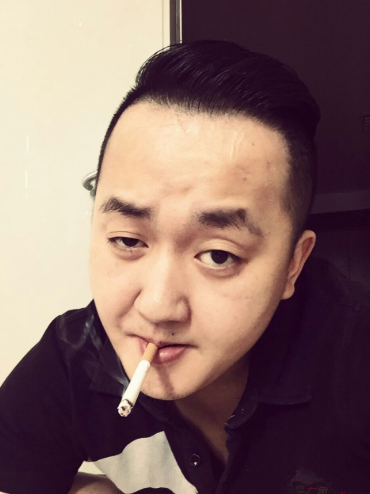 4級脫發(fā)植發(fā)分享我的經(jīng)歷，成都植發(fā)2800單位