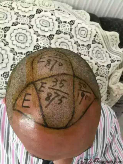 來到南寧雍禾植發(fā)3600單位，我也要光鮮亮麗的站在陽光下