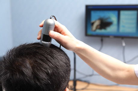 杭州植發(fā)需要多少錢，價(jià)格貴不貴