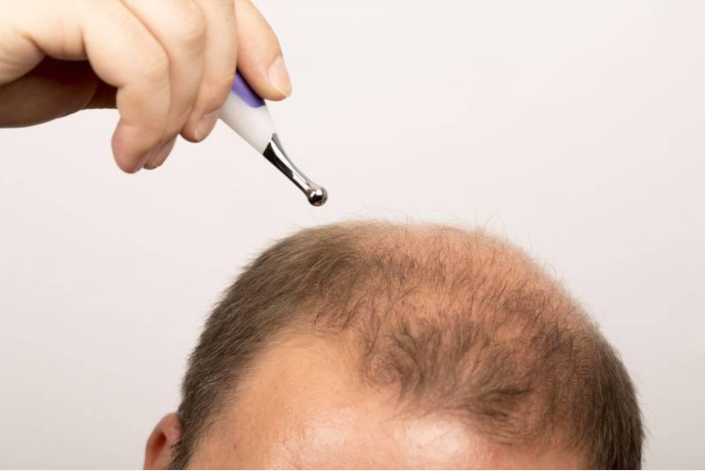 南京植發(fā)醫(yī)院排行榜