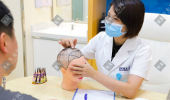 雍禾植發(fā)價格（全新）